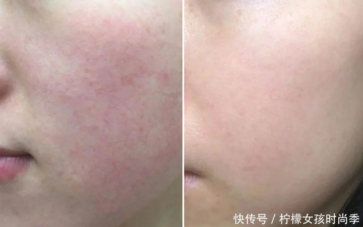 护肤品|618护肤品“红黑榜”出炉,这三种没必要买,没效果还浪费钱