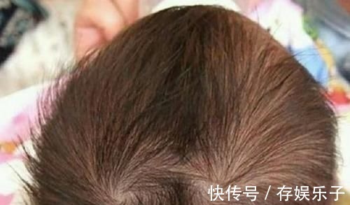 小伟|孩子头顶几个旋暗示着什么?别乱猜,科学的解释爸妈要牢记