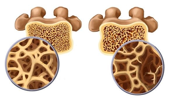 钙片|吃一口相当于2瓶钙片,若你爱吃,骨骼一天比一天强壮