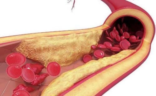 降脂药|血脂高的人,不想血管堵死,拿它煮水一喝,畅通血管,胜过降脂药