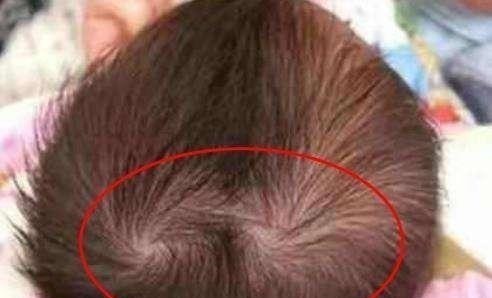 父母|为什么有的孩子头上有“2个旋”代表什么意思,父母要知道!