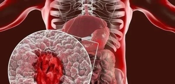 近视|坚持跑步的好处有哪些？科学跑步，要注意什么？现在就逐个分析