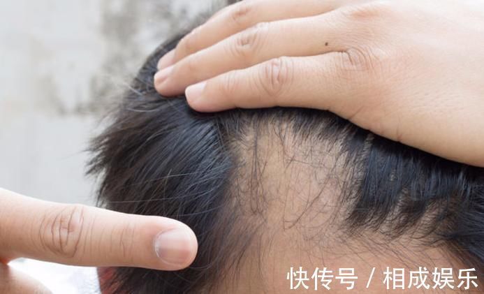 身体|男性开始变老的6大迹象,若一个不占,说明身体还很健康