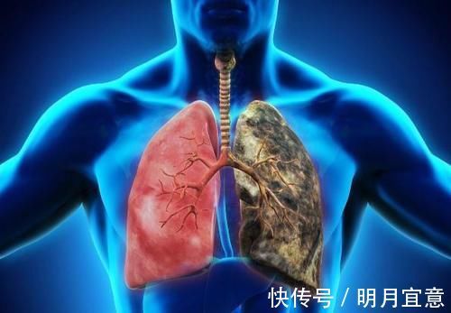 清肺|肺部“吸尘器”找到了，不是白萝卜而是它，可劲吃，清肺更养肺！