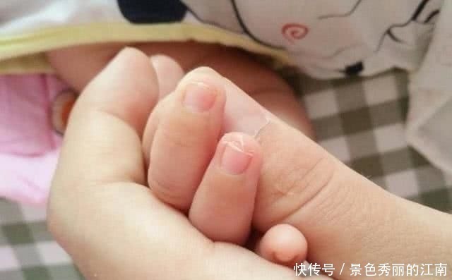 孩子|儿科医生提醒孩子缺锌身上有这些表现,粗心的家长别再无视了