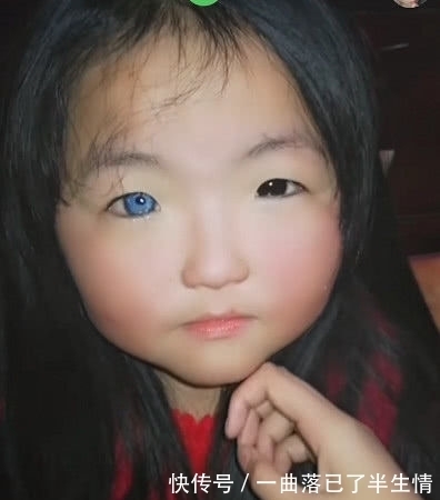 小萝莉|奇闻:小萝莉天生“异瞳”,当她睁开眼的瞬间,感受到二次元气息