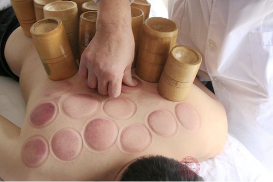 拔罐后多久能洗澡