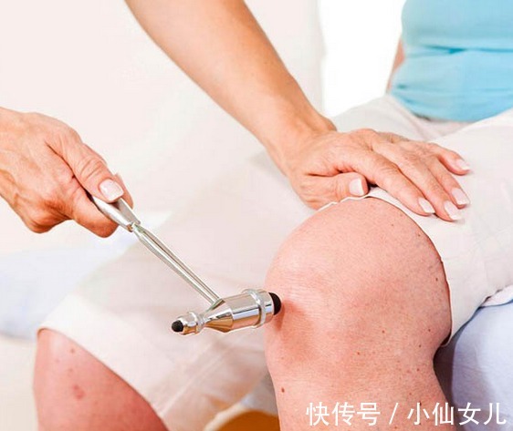 bmi|骨伤科教授王飞提醒，肥胖人群是关节炎的高发人群