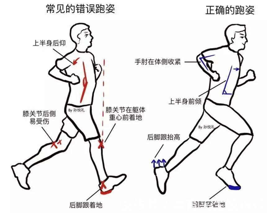 损伤|跑步、骑行、游泳,什么运动才不伤膝盖?