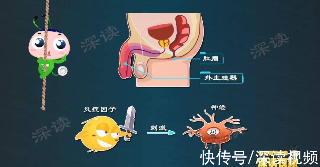 深读君|私处反复疱疹、溃烂？解密生殖器疱疹症状背后的真实原因，超赞