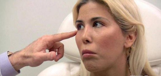 iv女子花重金整容,一年经历13次整容手术,整容前后判若两人