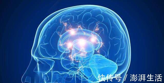 萃枫苷|最新老年痴呆测试一张神秘图片,或能测出你脑部的衰老程度