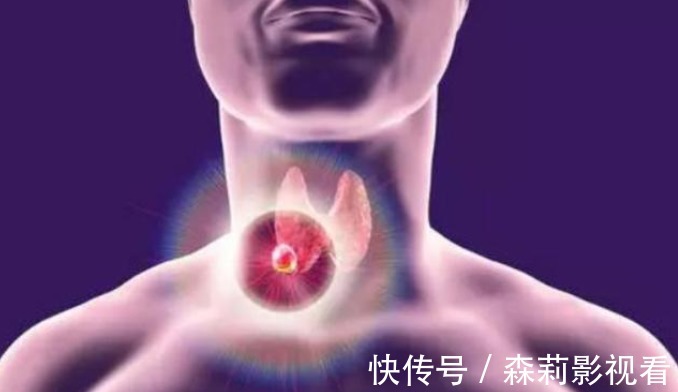 胆固醇|甲状腺结节不能吃葡萄吗?建议:这3类食物,再馋也不要贪吃