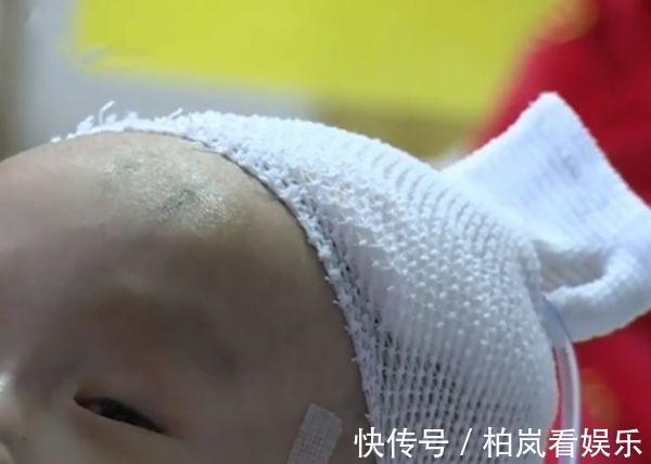 消瘦|因为一时疏忽,出生时8.8斤的宝宝一个月后骨瘦如柴,家长要警惕