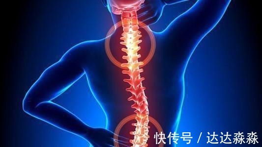 腰椎|如何预防腰椎间盘突出反复发作,夏天可以这样做