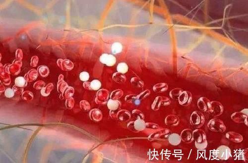 遗传病|母亲有这3种遗传病,只“传男不传女”,如果有希望你能生女儿