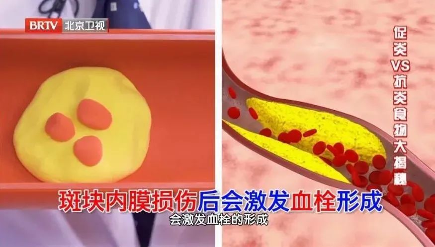 全麦|血栓形成竟和“它”密切相关！常吃2种颜色的食物，帮你护血管、防血栓