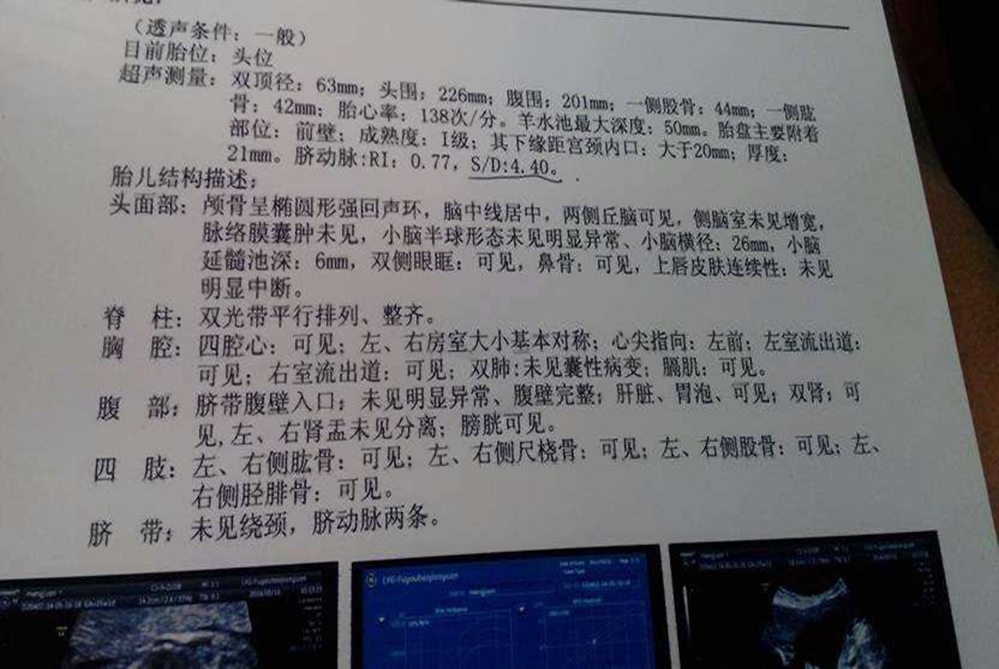 警告|怀孕后内裤有异样?可能是胎儿发出的警告,孕妈要懂“内裤隐忧”