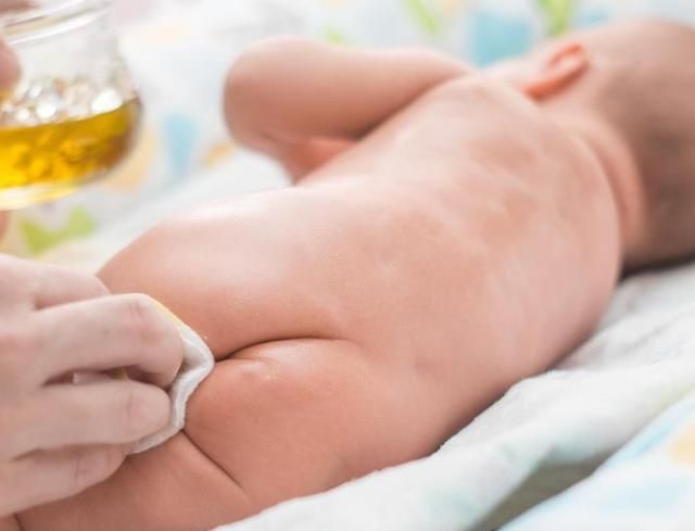 臀部|3个月宝宝坚持用护臀膏,还是起尿布疹?过来妈咪谈经验……