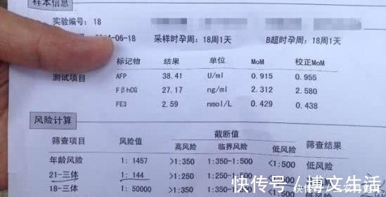 胎儿|孕妇最痛苦的两项产检, 有一项很多孕妈没通过, 整个孕期惶恐不安