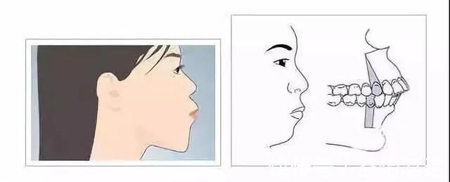 不良习惯|孩子12岁前必须处理的牙齿问题!家长都了解吗?