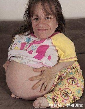 美国身高70厘米的袖珍妈妈，身体肿如气球，如今俩孩子