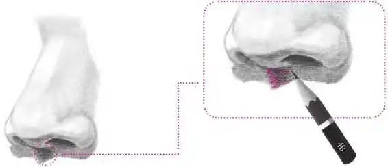 鼻孔@零基础素描教程:分步骤讲解34侧面鼻子画法,简单易学,快临摹