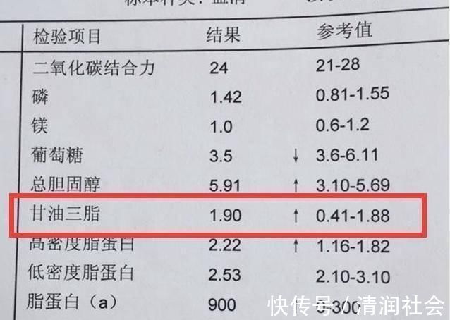 高血脂|甘油三酯大于17界点,暗示血脂超标,3个小妙招快、狠、准