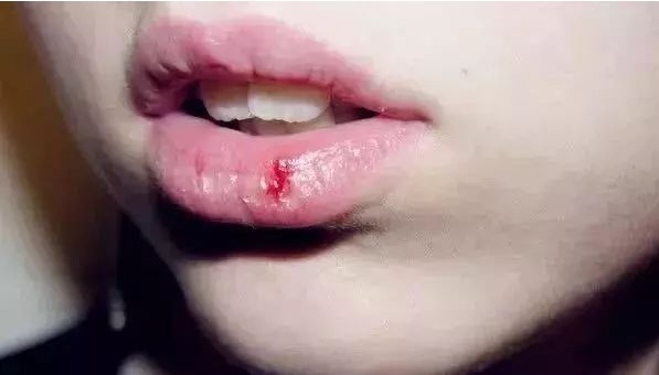 坏习惯 4个坏习惯让“嘴唇”越来越丑,涂口红都救不了,护唇也是抗衰
