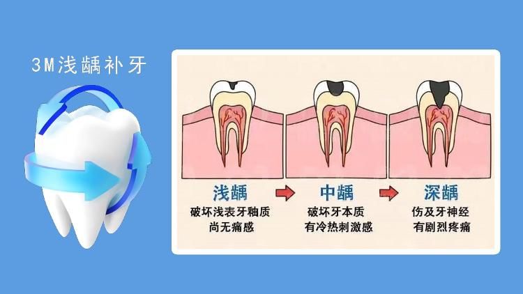 电动牙刷|潍坊新城口腔举办2022年虎年产品发布会暨全民公益爱牙活动