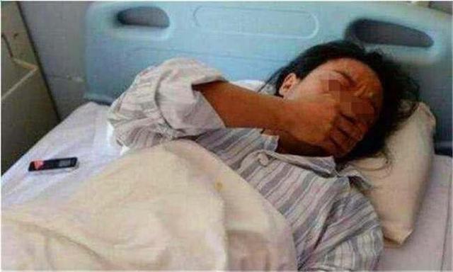 孩子|男婴因吃奶太用力,被妈妈用剪刀亲手毁容,4年后现状令人感慨