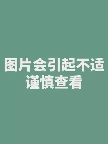 乳腺外科|近50厘米！24斤！中六“拆弹团队”奋战3.5小时取下乳腺巨大肿瘤