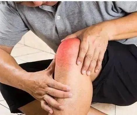  增加|尿酸高的人，多注意，4件事最好一个不要做，是痛风的“加速器”