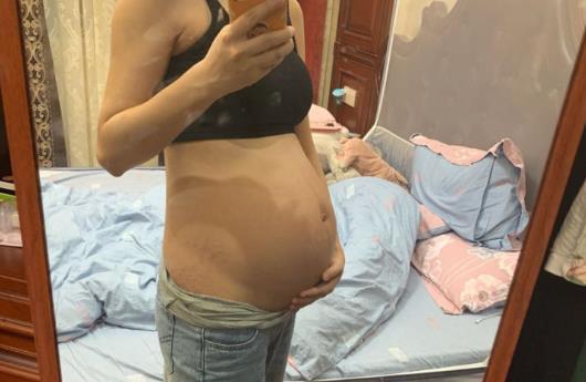 孕晚期|孕晚期肚子大,胎儿却诊断偏小?准妈妈要得到重视