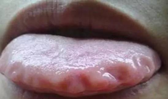 薏仁|只要经常拍几个部位，肚子就能瘦一圈，大家一起试试看吧！