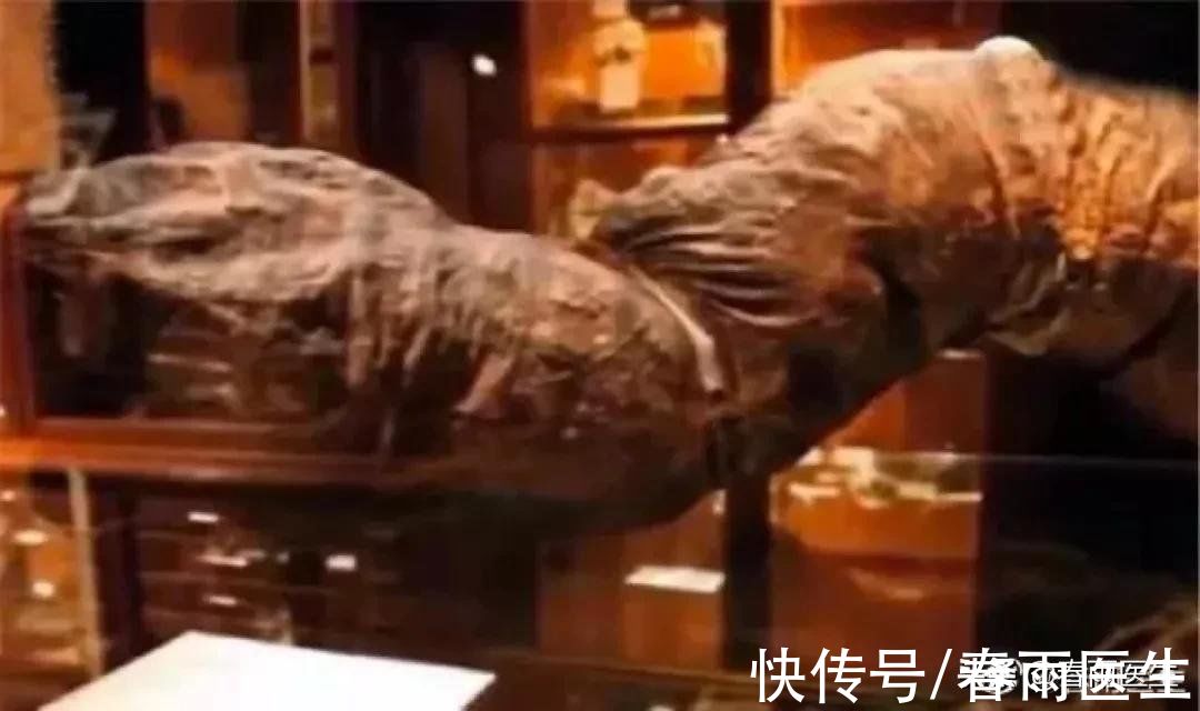 春雨君|不会吧不会吧?都2021年了还有人相信“宿便”这种鬼话