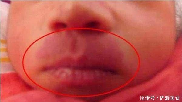 怀孕期间|怀孕期间，孕妇最好不要做这四件事，容易让宝宝将来有《胎记》