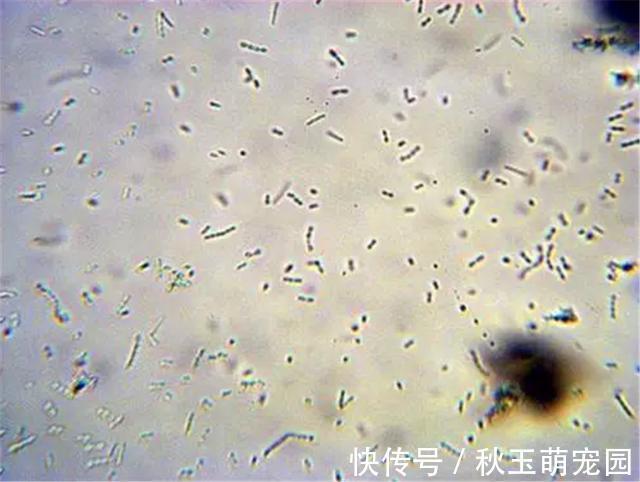 肚子疼!肚脐眼里的“泥”到底是啥?能不能抠?显微镜放大1000倍,真酸爽