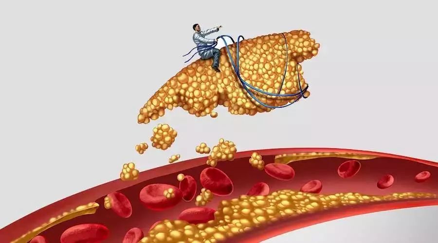 心脑血管疾病|出租司机突发脑溢血,抢救无效离世,高血压者切莫两件事一起做!