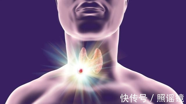 活动度|结节就是早癌？作为全身几十枚结节的医生，有些话想对结节患者说