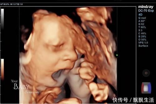 淘气|胎儿性格隔着肚皮能看出来吗?孕期欢脱的胎儿,出生后也多调皮