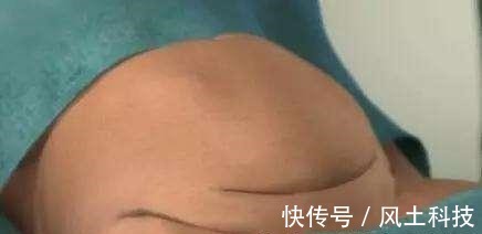 宫内孕|明明是宫内孕,为什么医生说不能要古代女性却没有这个烦恼!