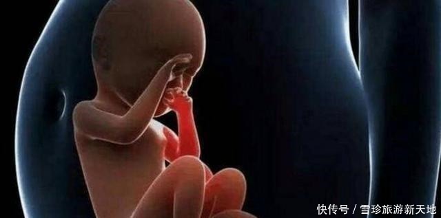 殷医生|女子怀孕30周，胎儿一脚“踢破”产妇子宫，母子差点双亡！