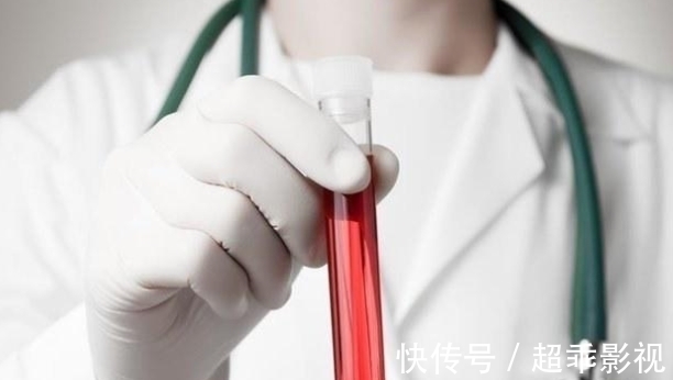 血管|3种食物是血管“软化剂”,血脂高的人不妨多吃,血管柔软又通畅