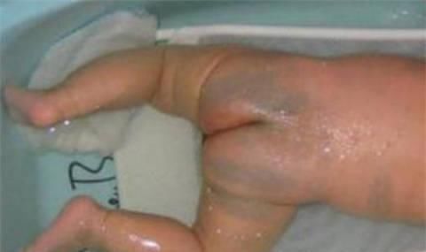 身体|孕妇最忌讳的就是做这样的事情,小心宝宝出生后满身胎记