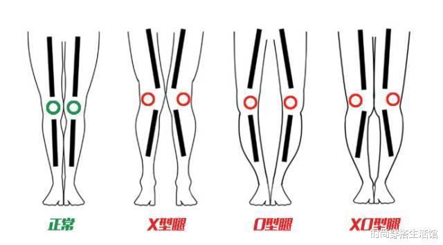 直筒裤|立秋后别只穿裙子,土气!今年流行这样穿,轻松穿出高级感