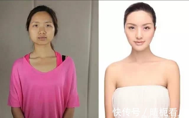 美白|实拍:10张女孩整容前后的对比照,这真就是换了一张脸