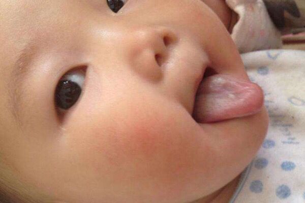 宝妈|孩子如果出现这四种情况可能是积食了,父母一定要注意!