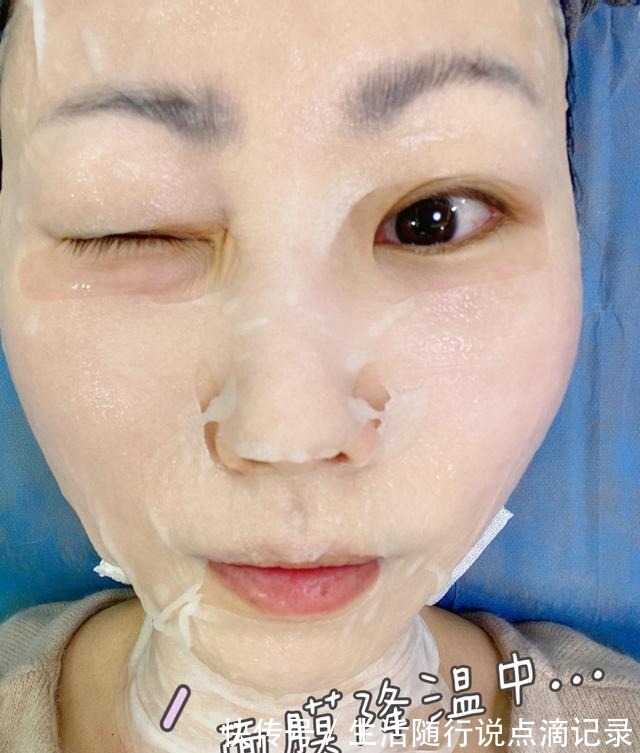 面部 对抗地心引力一直在路上丨面部热玛吉初体验!