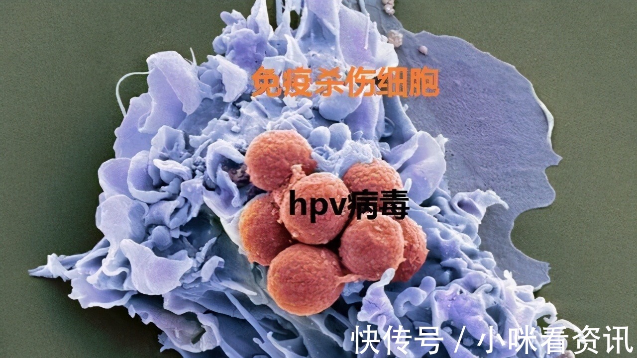 医生|23岁了还不会洗底裤医生用3种方式洗底裤,HPV迟早会来